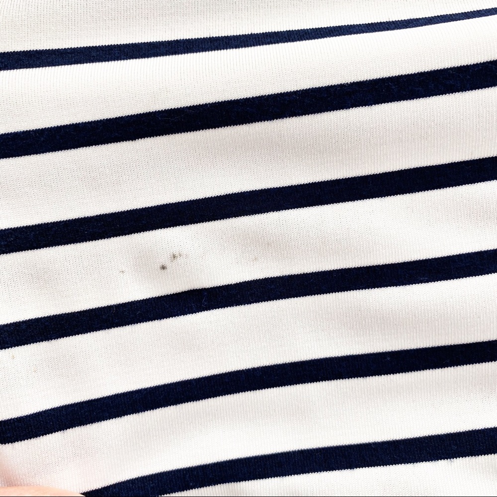 HYFVE Oversized Striped Tunic Dress - Picture 6 of 6